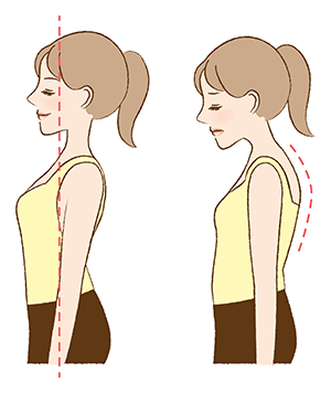 猫背の女性イメージ
